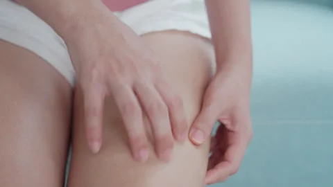 Skin problem and beauty. Young woman scratch skin leg has itchy skin from s.. Stock Footage 344511715