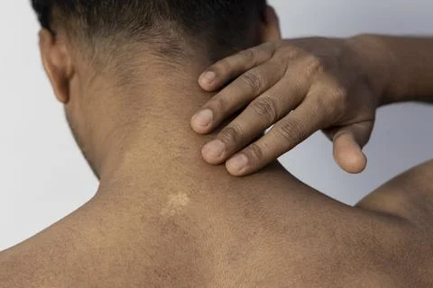 Skin problem Stock Photos