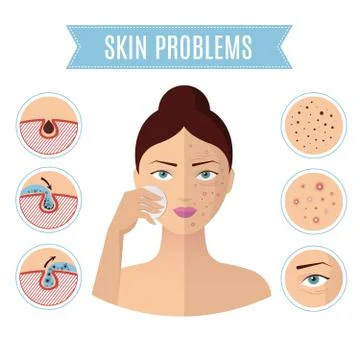 Skin problem solving, acne treatment and cleansing pore for perfect womans face 스톡 일러스트