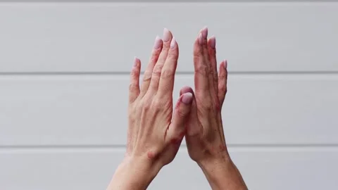 Skin problems guide for eczema, psoriasis, and dermatitis treatment and Stock Footage 317717358