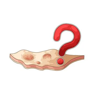 Skin problems illustration Stock Illustration