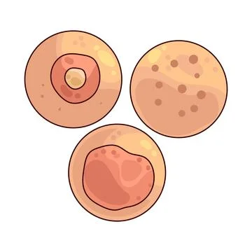 Skin problems illustration Stock Illustration