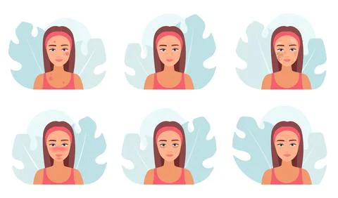 Skin problems set, collection of female characters with troubles of aging and Stock Illustration