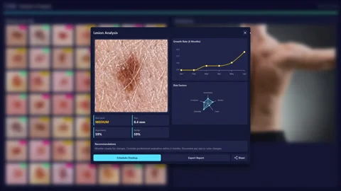 Skin Screening And Diagnosis Software Vídeos de archivo 328711252