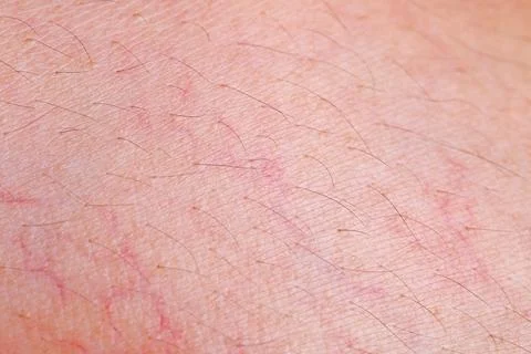 Skin texture with capillary for pattern Stock Photos