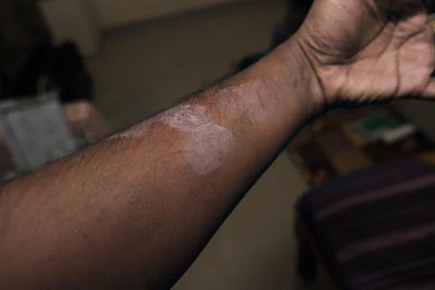 Skin texture of a human arm with light blemish on surface Stock Photos