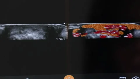 Skin texture on screen 6 Stock Footage 327398928