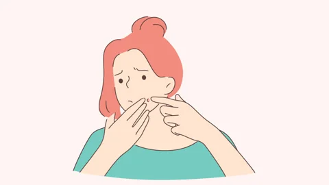 Skincare, acne problem, puberty concept Stock Footage 143456365