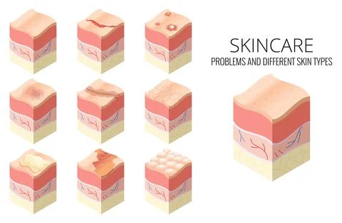 Skincare medical concept. Set of problems of different skin types in cross Stock Illustration