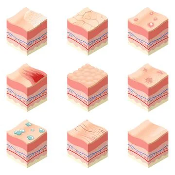 Skincare medical concept. Set of problems of different skin types in cross Stock Illustration