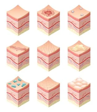 Skincare medical concept. Set of problems of different skin types in cross Stock Illustration