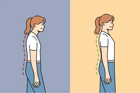 Skoliose oder Osteochondrose bei der Frau, aufgrund von Haltungsproblemen ... Stock Photos