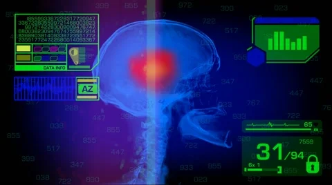 Skull Analysis - Graphics - Green 02 Stock Footage 56841115