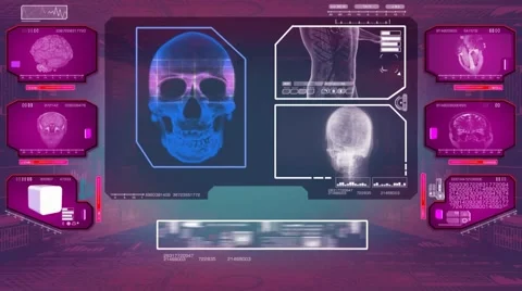 Skull Analysis  - High Tech Scan - Pink 01 Video stock 58506108