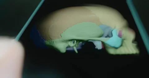 Skull bones highlighted with different colors Stock Footage 313838840
