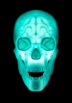 Skull brain x-ray Illustrazione stock