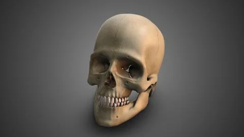 A skull with Broken Jaw Ilustración de archivo