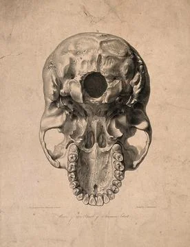 Skull of 'a human idiot' seen from below. Lithograph by G. Scharf, after J... Stock Illustration