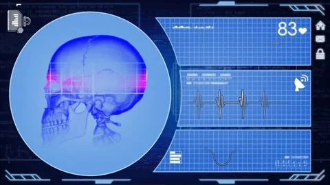 Skull - Interface - medical screen - blue Stock Footage