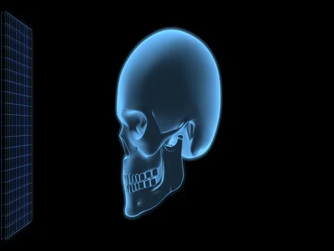 Skull scan concept Stock Footage 77404759