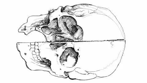 Skull. Section. Based on drawing of Leonardo da Vinci Stock Footage 262305500