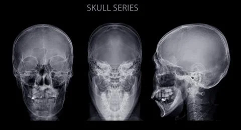 Skull skull series Illustrazione stock