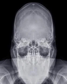 Skull towne's view . Stock Illustration