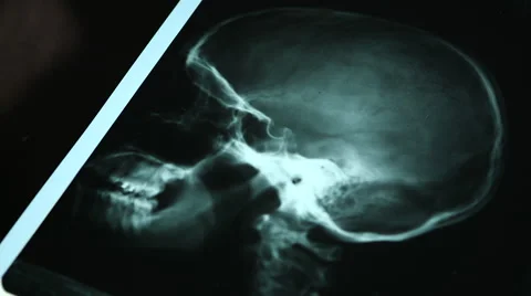 Skull x-ray Vídeo Stock 44874437