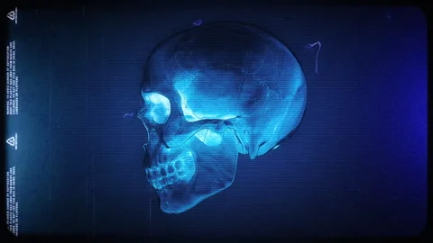 Skull X-Ray Stock Footage 240718257