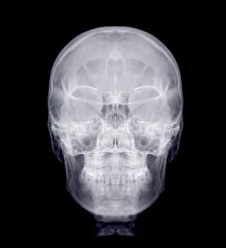 Skull x-ray image of Human front view  . Stock-Illustration