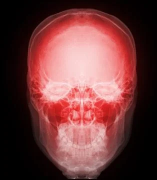 Skull x-ray image of Human front view. Stock Illustration