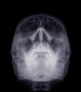 Skull x-ray image of Human water's view. Stock Illustration