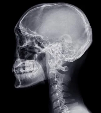 Skull x-ray image of Human name is skull lateral view isolated on Black Backg Stock Illustration