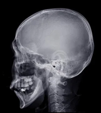 Skull x-ray image of Human name is skull lateral view isolated on Black Backg Stock Illustration