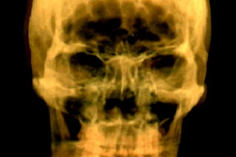 Skullstwist Stock Footage 112266