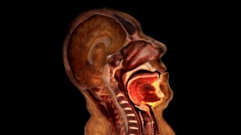 Sleep Apnea 스톡 동영상 90866761