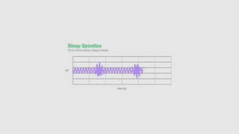 Sleep Spindles EEG Brain Wave Animation Labeled Video Overlay Alpha 4K Stock-Footage 339303825