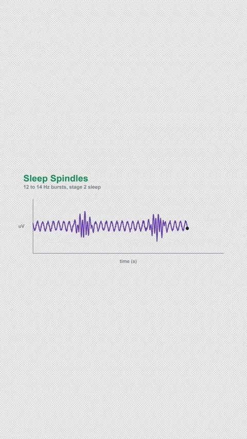 Sleep Spindles Labeled EEG Brain Wave Alpha 4K Vertical 9x16 Light Vídeos de archivo 339493954