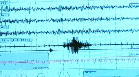 Sleep Study Data Stock Footage 299483