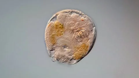 Sleeping rotifera under microscopy view 스톡 동영상 306576630