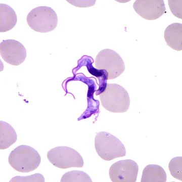  Sleeping sickness This Giemsa-stained light photomicrograph revealed the ... Photos