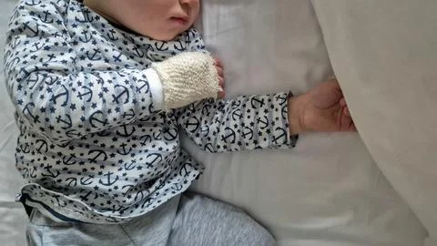 Sleeping toddler lying on bed with protective bandage on hand, close-up view. Co Stock Photos