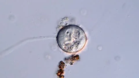 Sleeping Vorticella under the microscope 库存影片 310642158