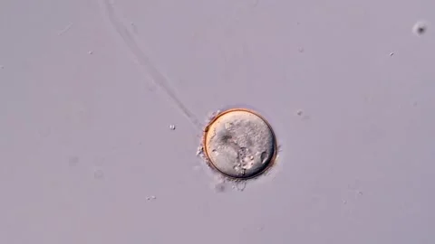 Sleeping Vorticella under microscopy view 库存影片 310357125