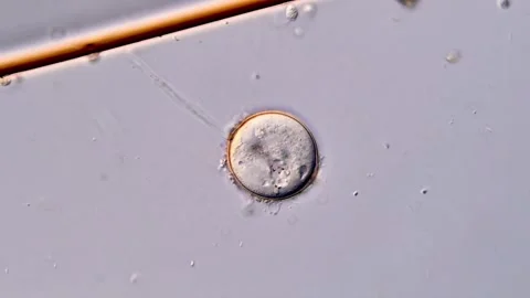 Sleeping Vorticella under microscopy view Vidéo 310358203