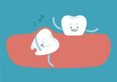 Sleepy tooth of impacted tooth Illustrazione stock