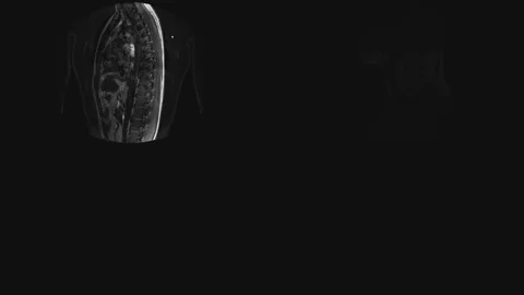Slicing different episodes of MRI scans of the human body. Examining and Stock Footage 115500448