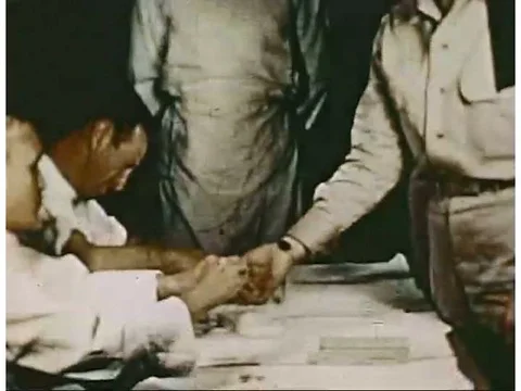 Slides with samples from a blood test are viewed under a microscope, showing the Stock Footage