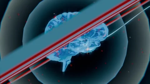 Sliding gray bar, red rails revealing 3D brain rotating, pulsing orange sparks Stock Footage 339721981