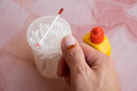 A slight wound in the right thumb is bleeding. Stock Photos